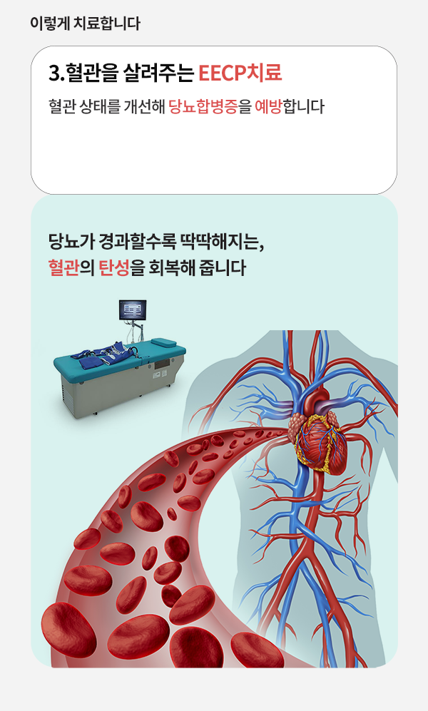 3.혈관을 살려주는 EECP치료
