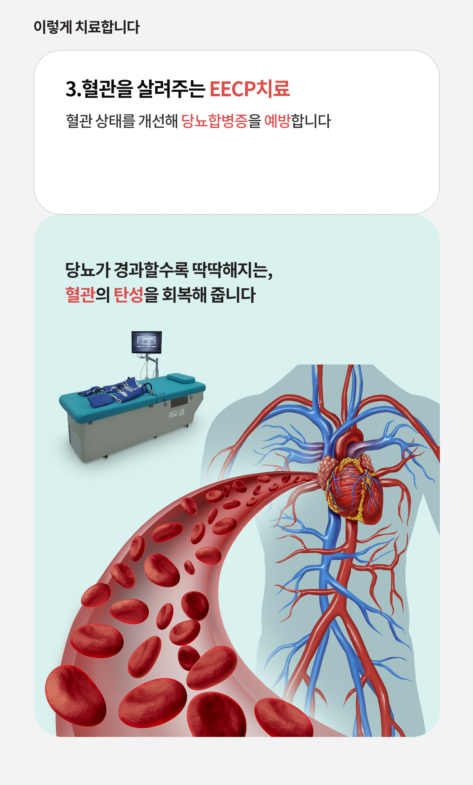 3.혈관을 살려주는 EECP치료